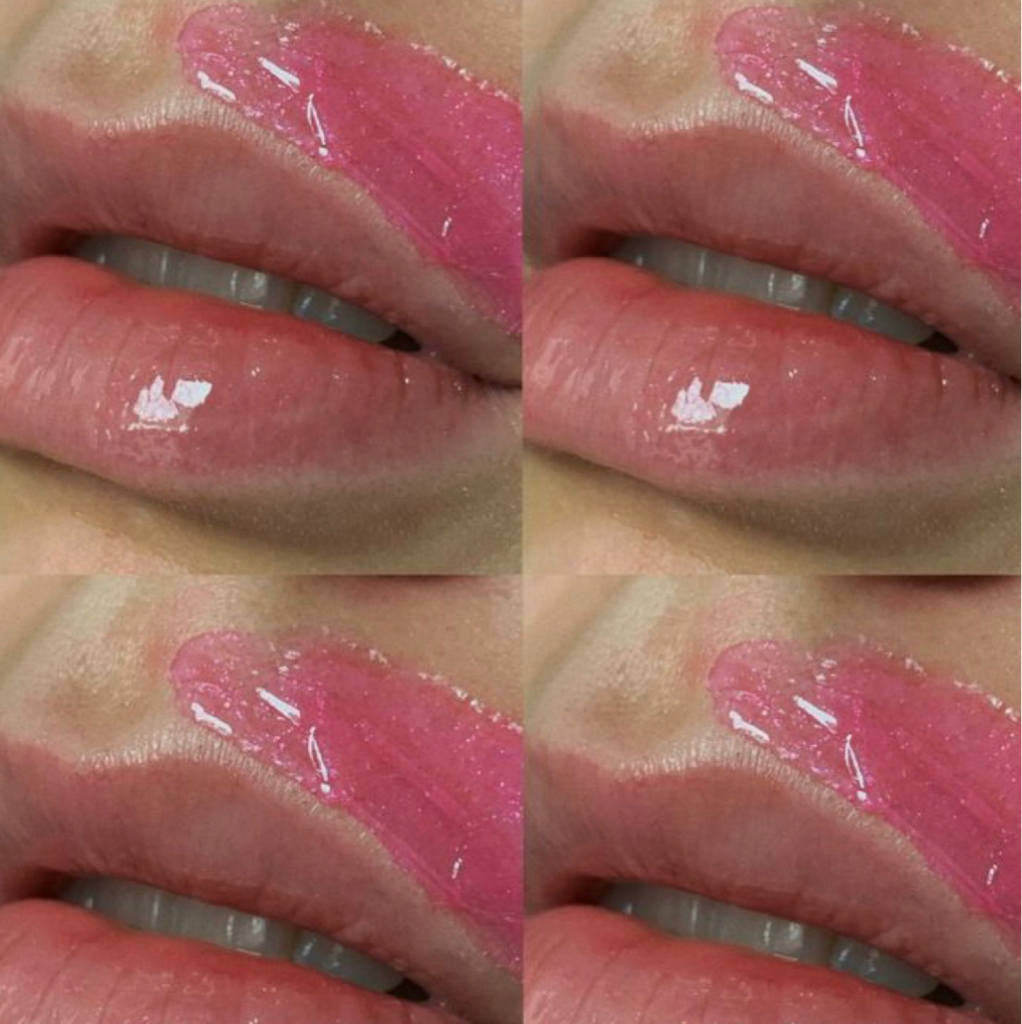 Верхняя губа