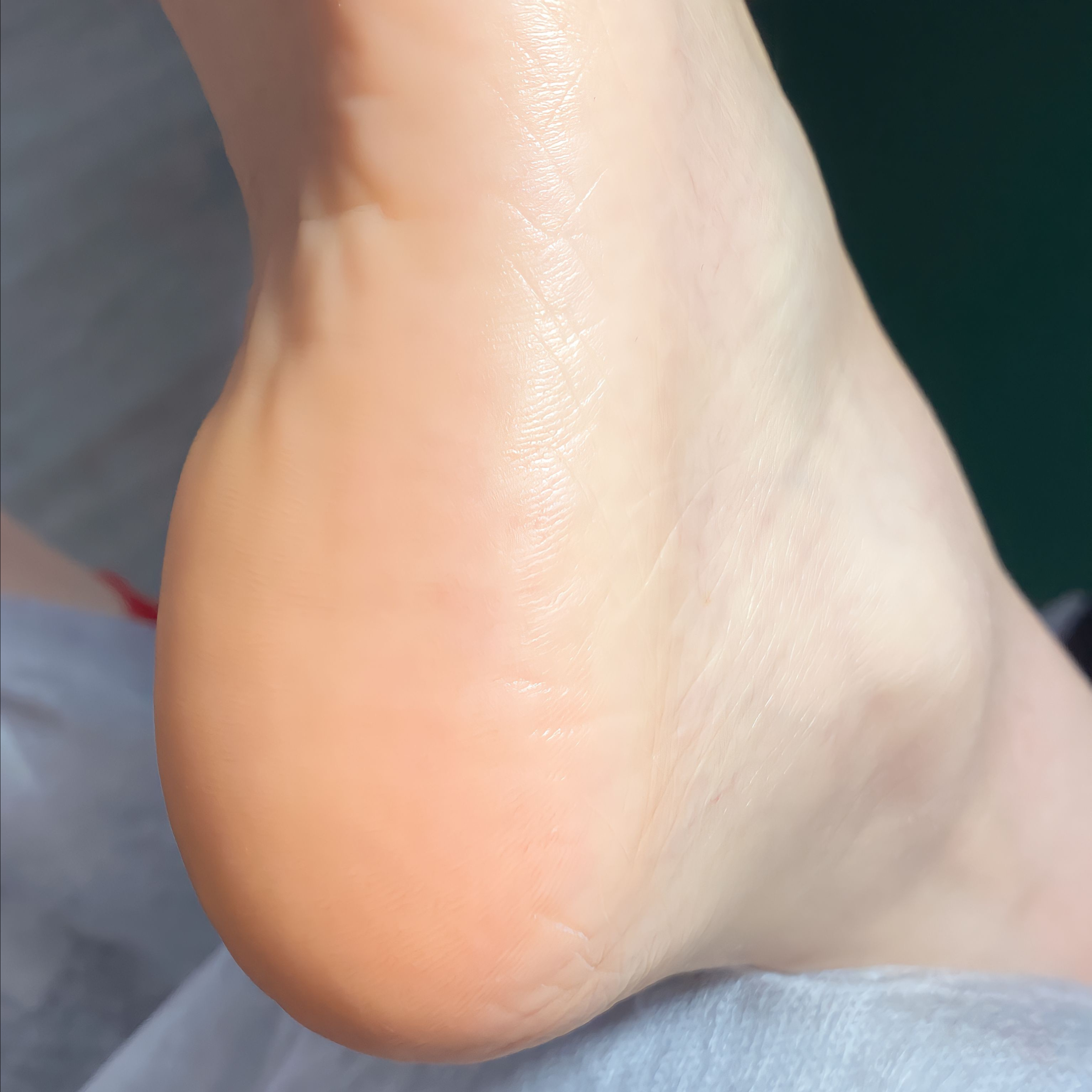 Обработка стоп