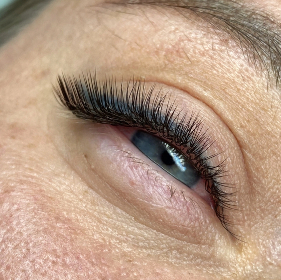 Объёмное наращивание 1,5D