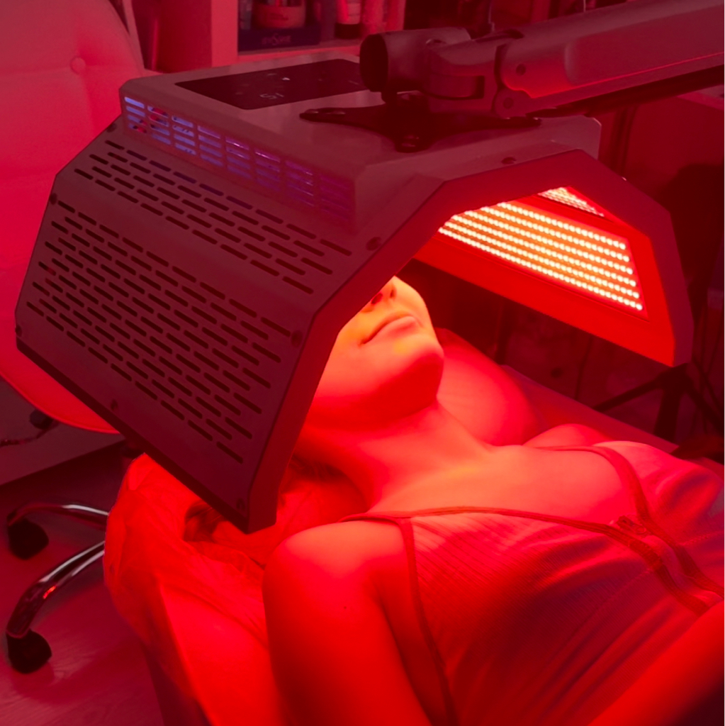 Фотодинамическая терапия Ala-Factor