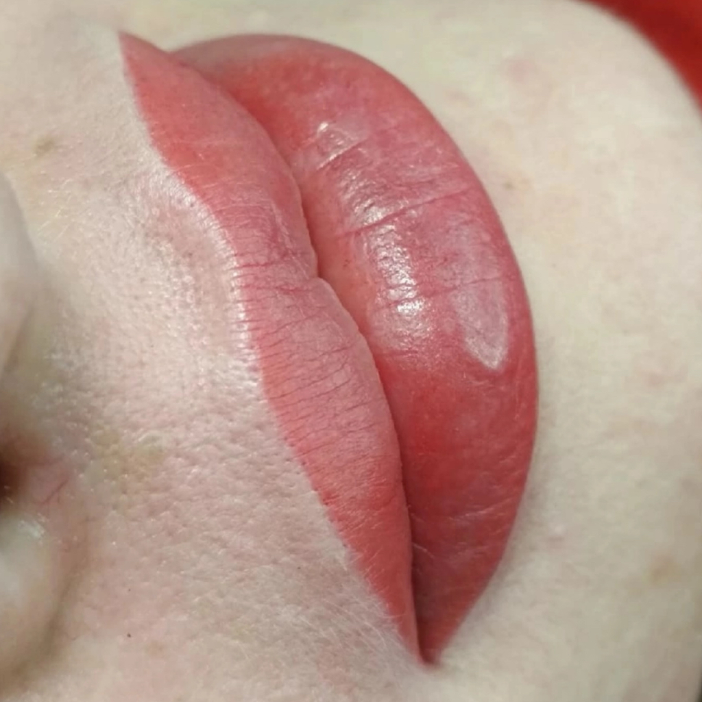 Губы первичная процедура