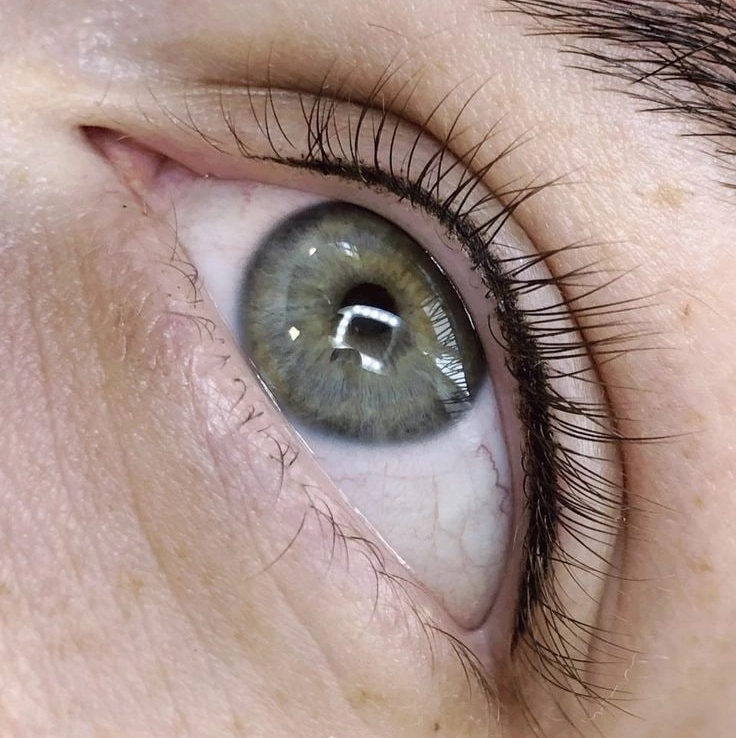 Межресничка