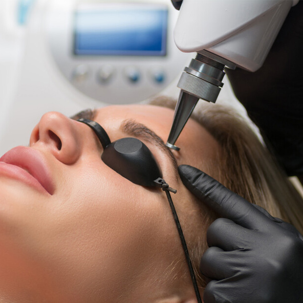 Лазерное удаление перманентного макияжа