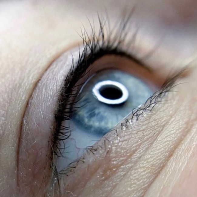 Заполнение межресничного пространства