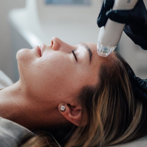 Пробный сеанс.Велашейп (VelaShape) лицо - 1 час