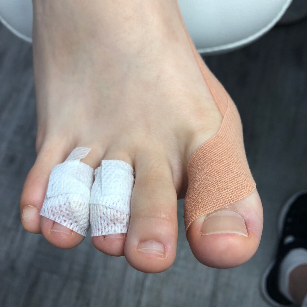 Ногти+мозоли