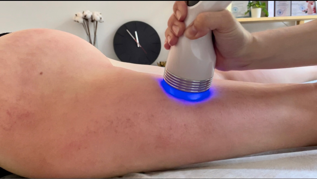 Resolady «Ноги полностью + ягодицы» (RF-лифтинг+уз-кавитация+вакуум)