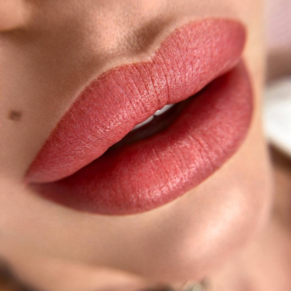 Коррекция губ