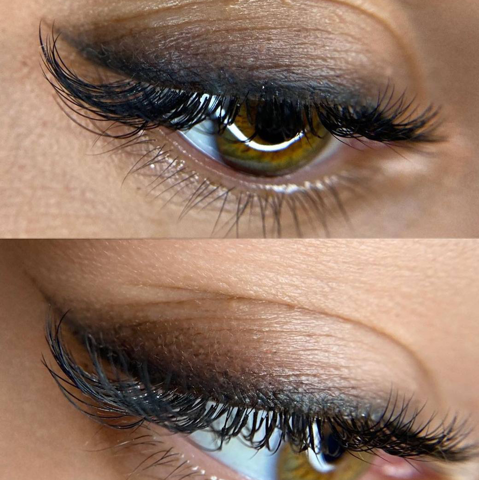 Коррекция межресничка, стрелка