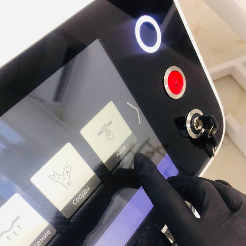 Лазерное лечение акне на спине