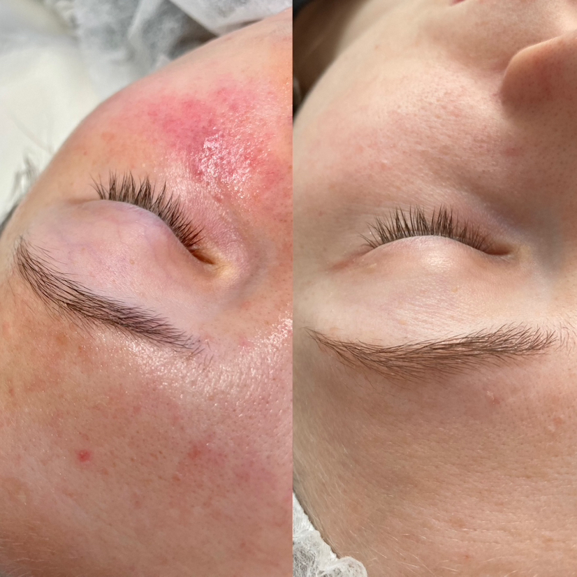 «Не знаю чего хочу» или подбор процедуры во время консультации «Ei tea mida soovin»