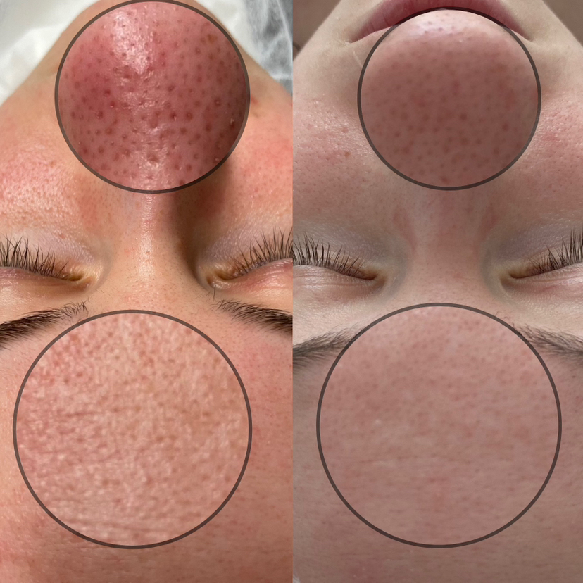 ЭНЕРГИЯ МОЛОДОСТИ: биостимуляция, насыщение кислотами