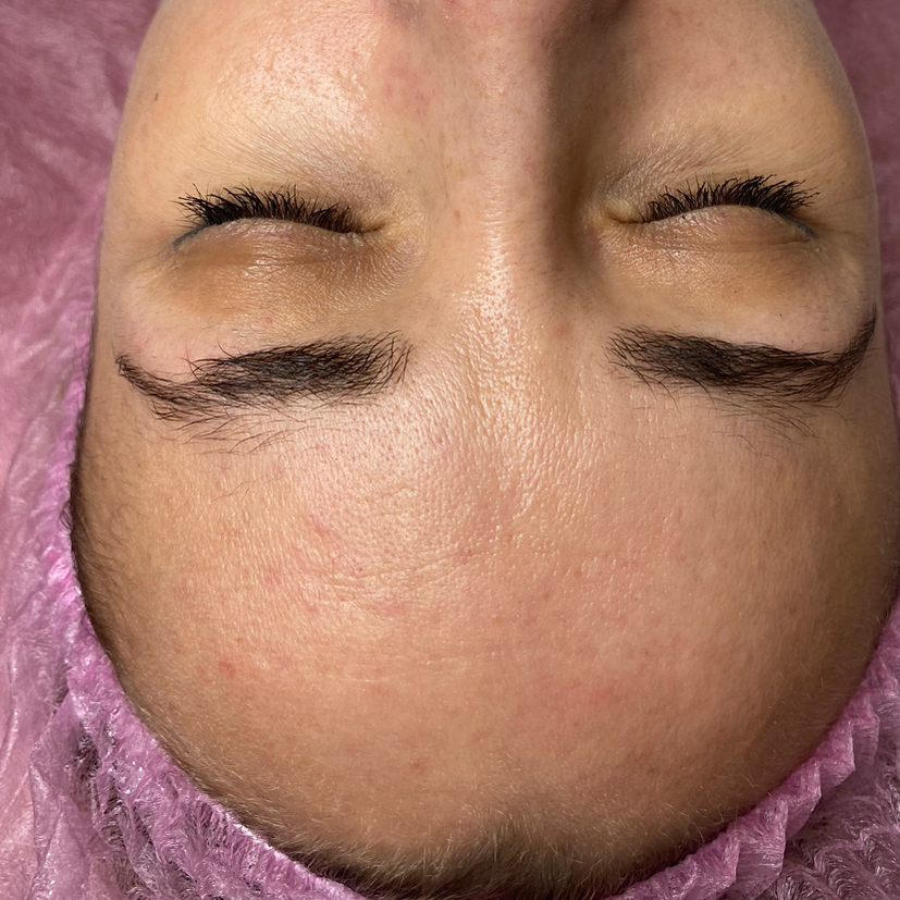 Массаж лица