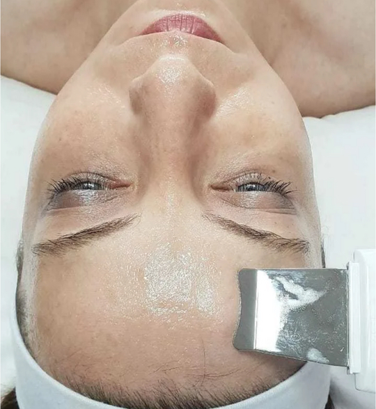 Ультразвуковая чистка ( экспресс процедура )