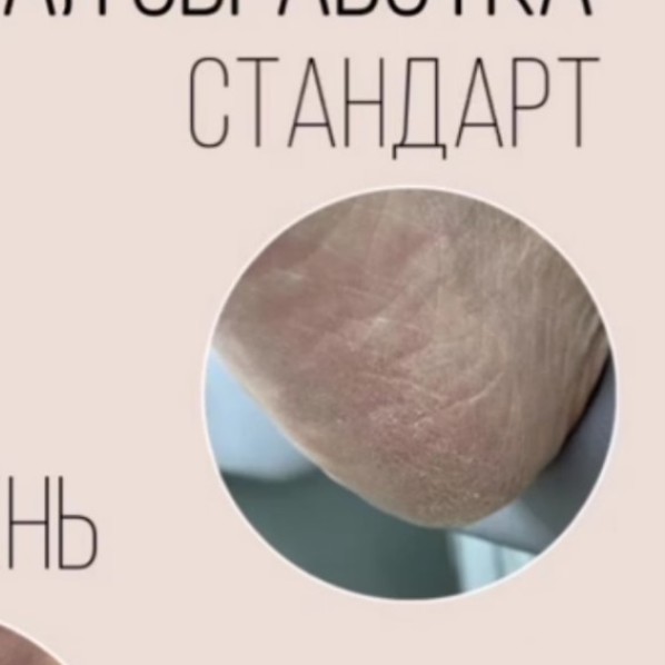 Обработка стоп стандарт