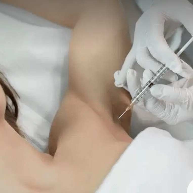 Лечение гипергидроза (повышенная потливость)