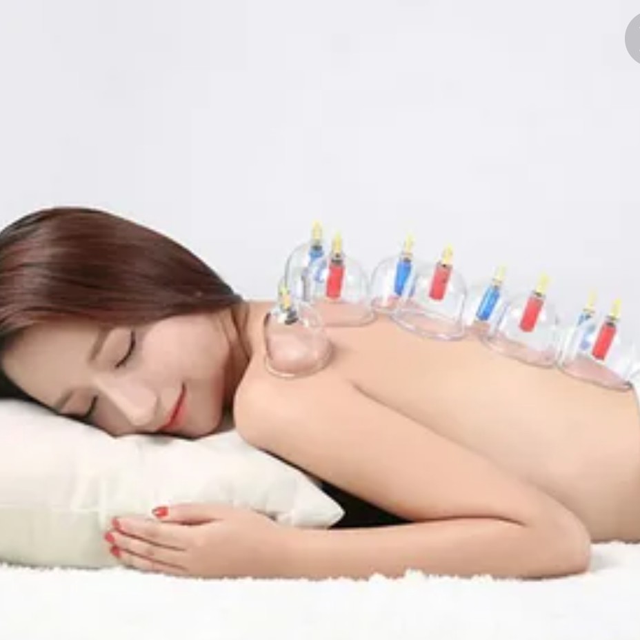 Хиджама(кровопускание) с банками