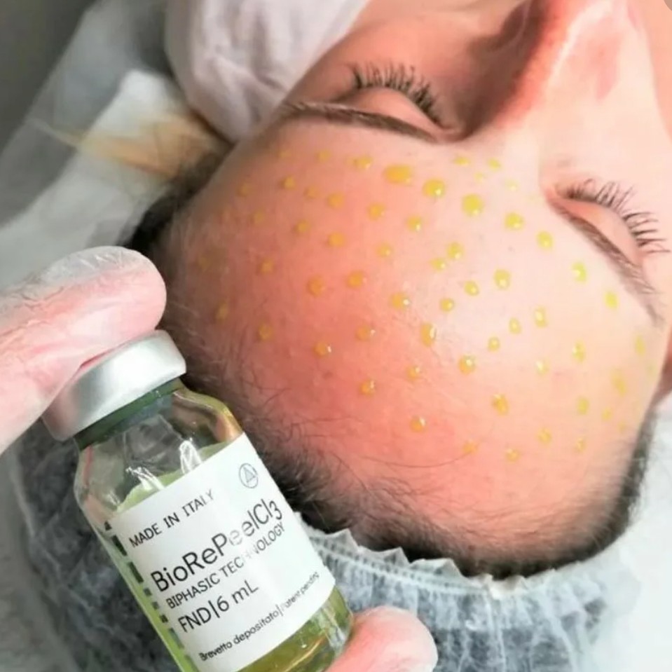 Пилинг Biorepeel