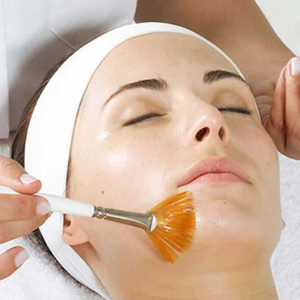 Азелаиновый пилинг