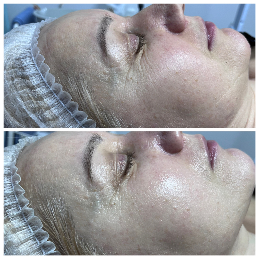 Массаж лица скульптурный