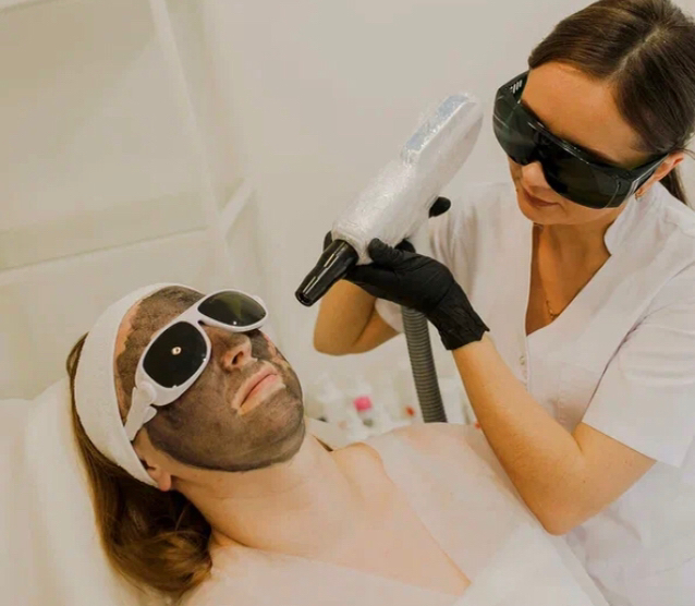 Карбоновый пилинг