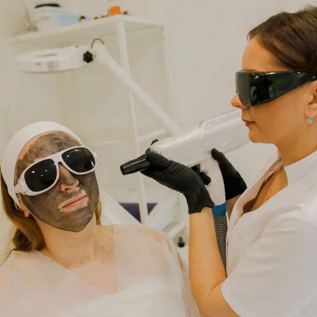 Лазерный карбоновый пилинг (лицо)