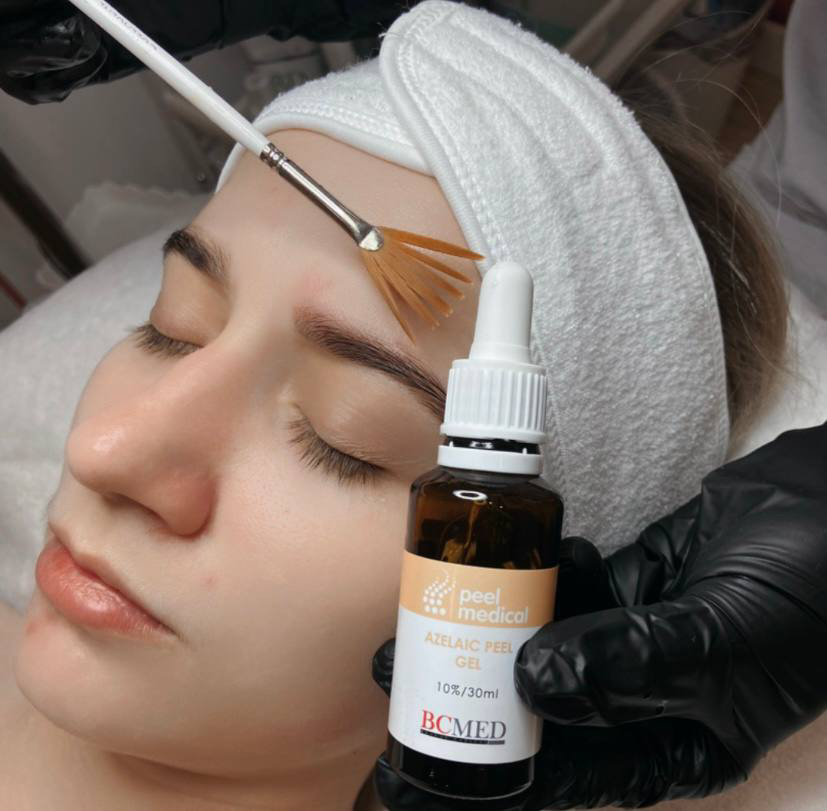 Пилинг азелоиновый поверхностный