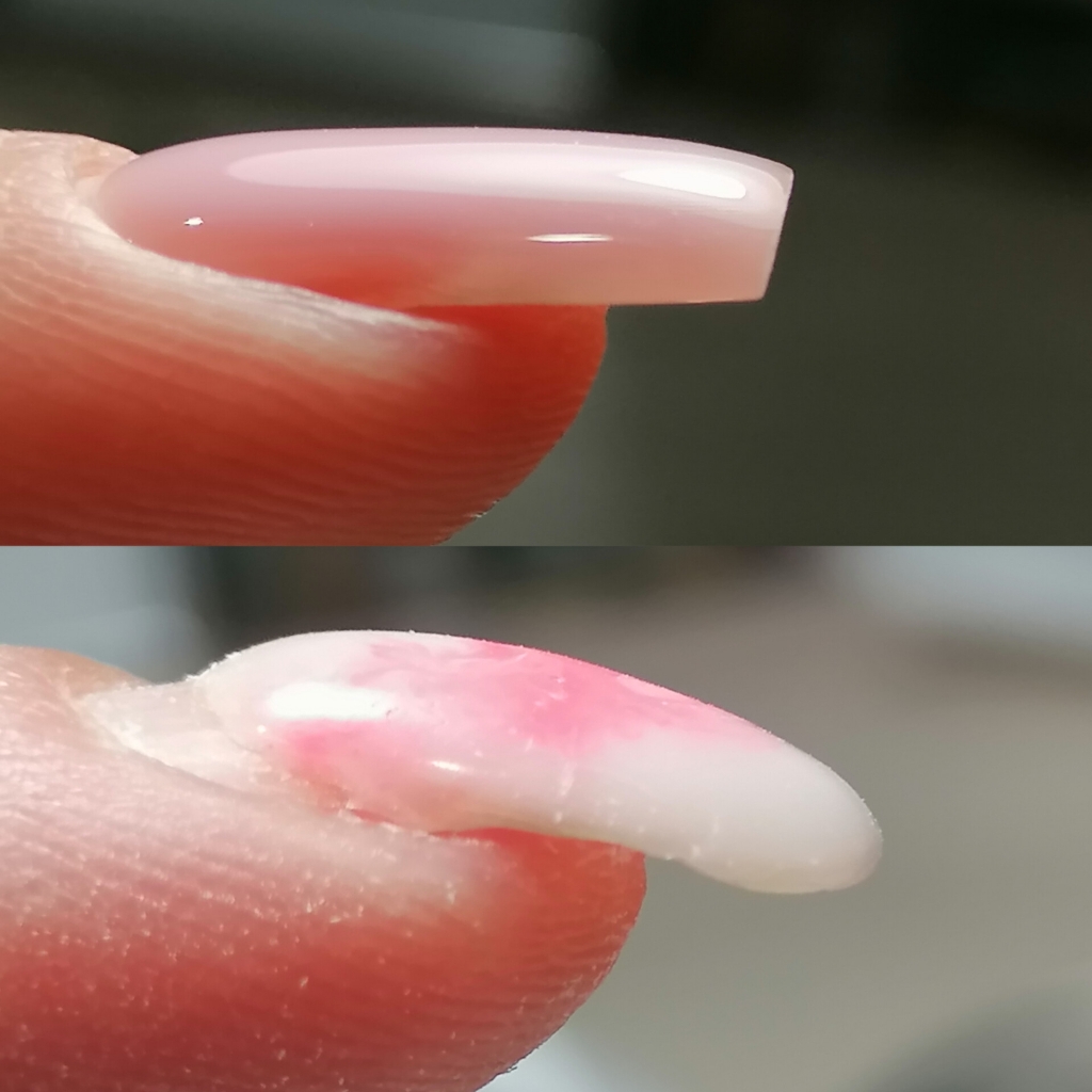 Поднятие клюющих ногтей (1 ноготь)