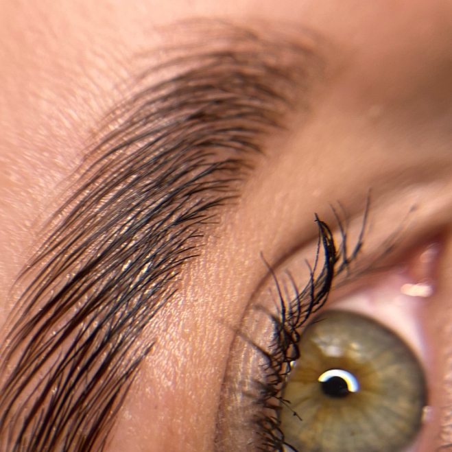 Удаление не желательных волос на лице