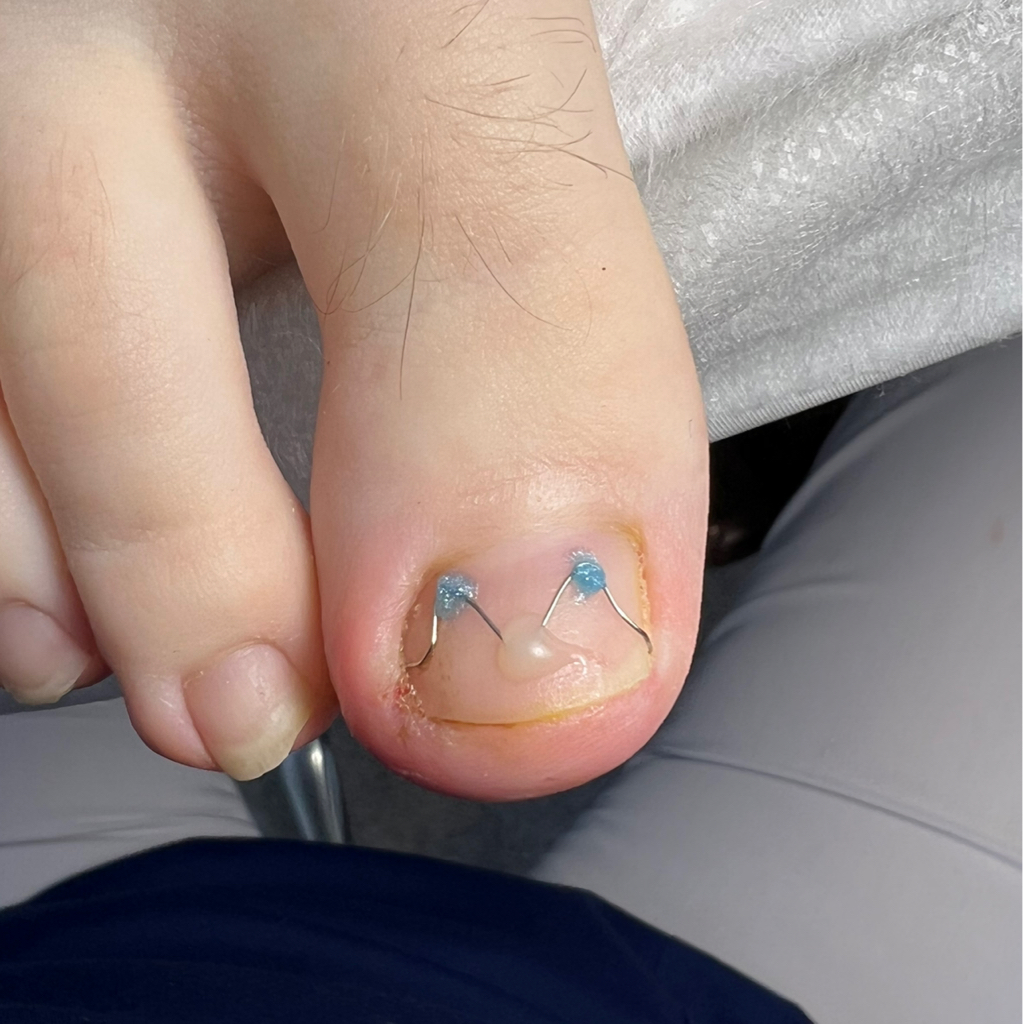 Коррекция коррекционной системы