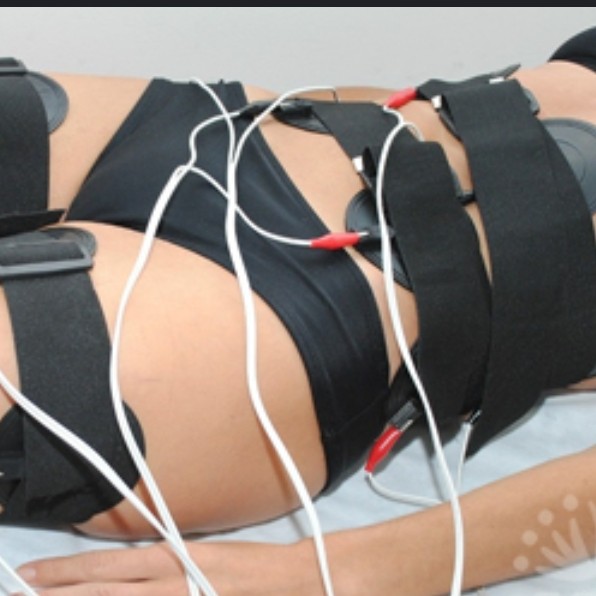 миостимуляция