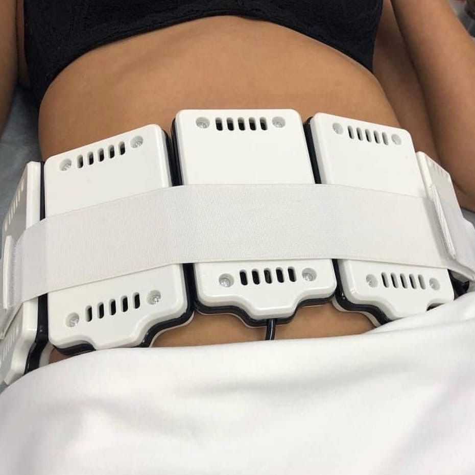 Лазерный липолиз