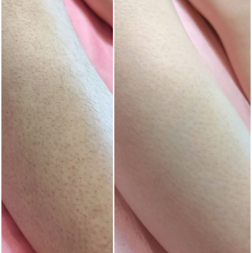 Ноги полностью(воск)