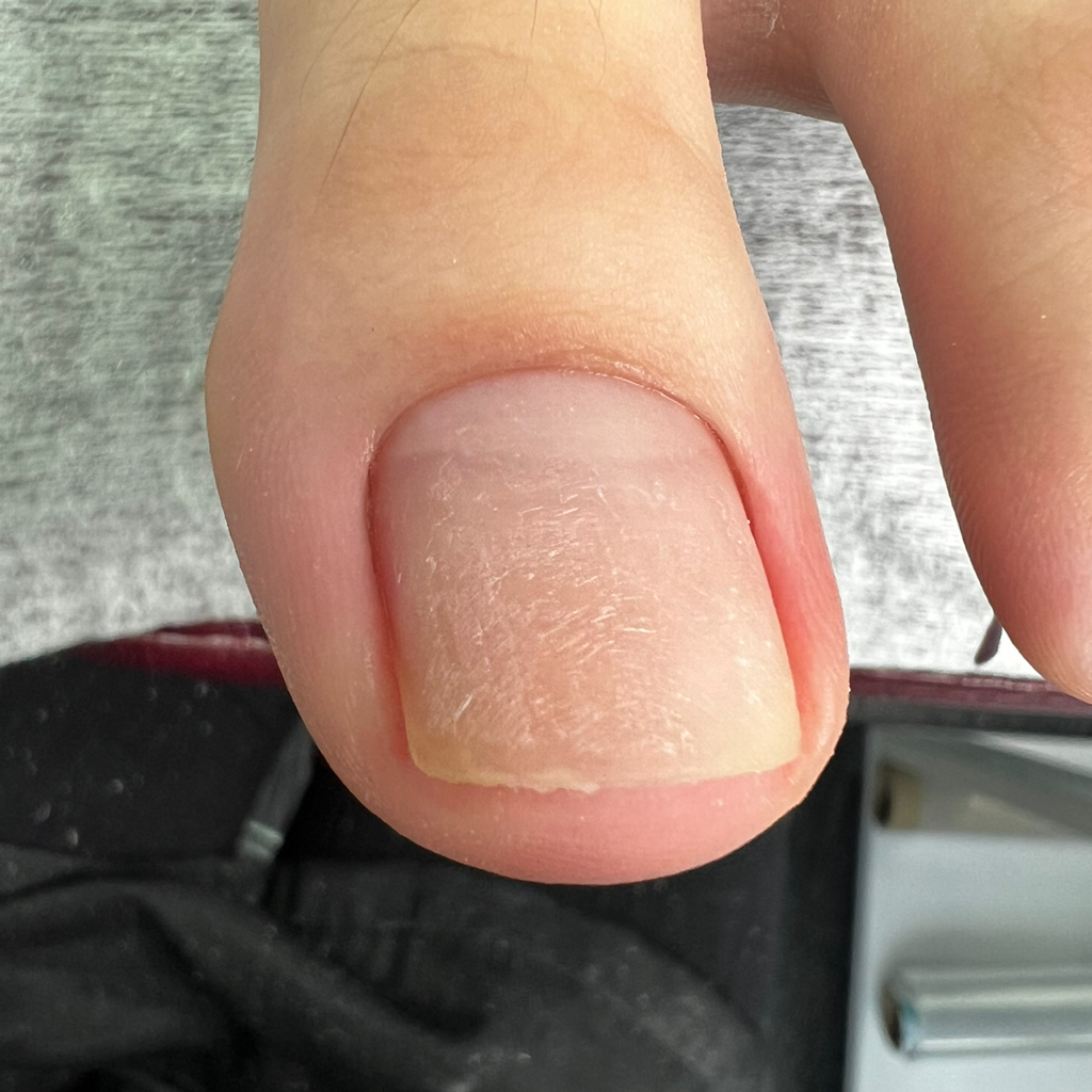 Педикюр обработка пальчиков