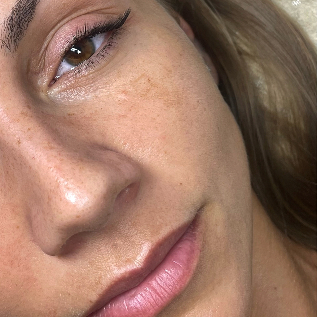 Уголки (3д-5д)