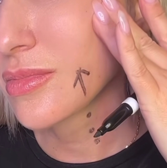 BOTOX PLATISMA+JAWLINE