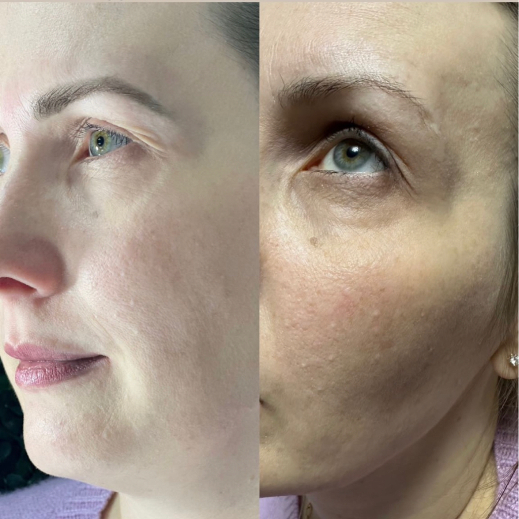 Окрашивание и коррекция краской