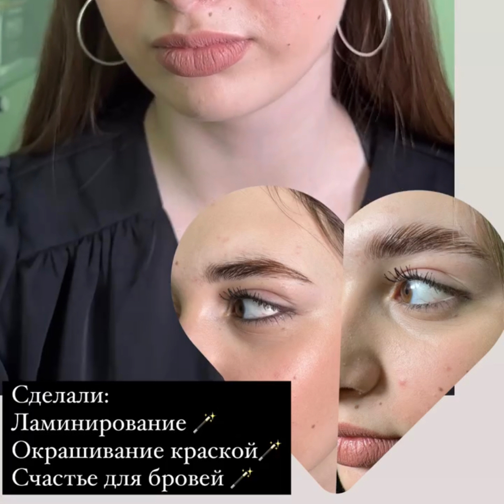 Комплекс брови