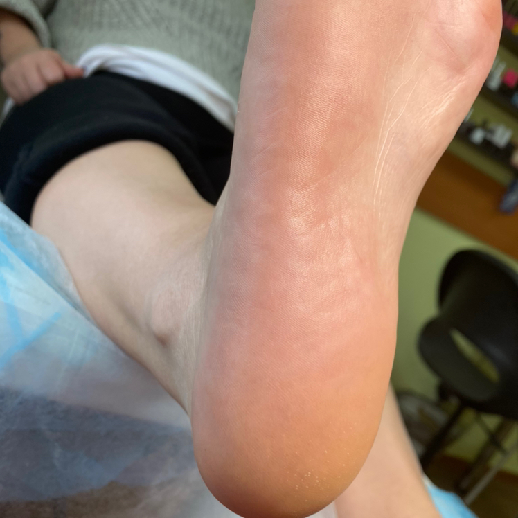 Обработка стопы или пальчиков без покрытия)