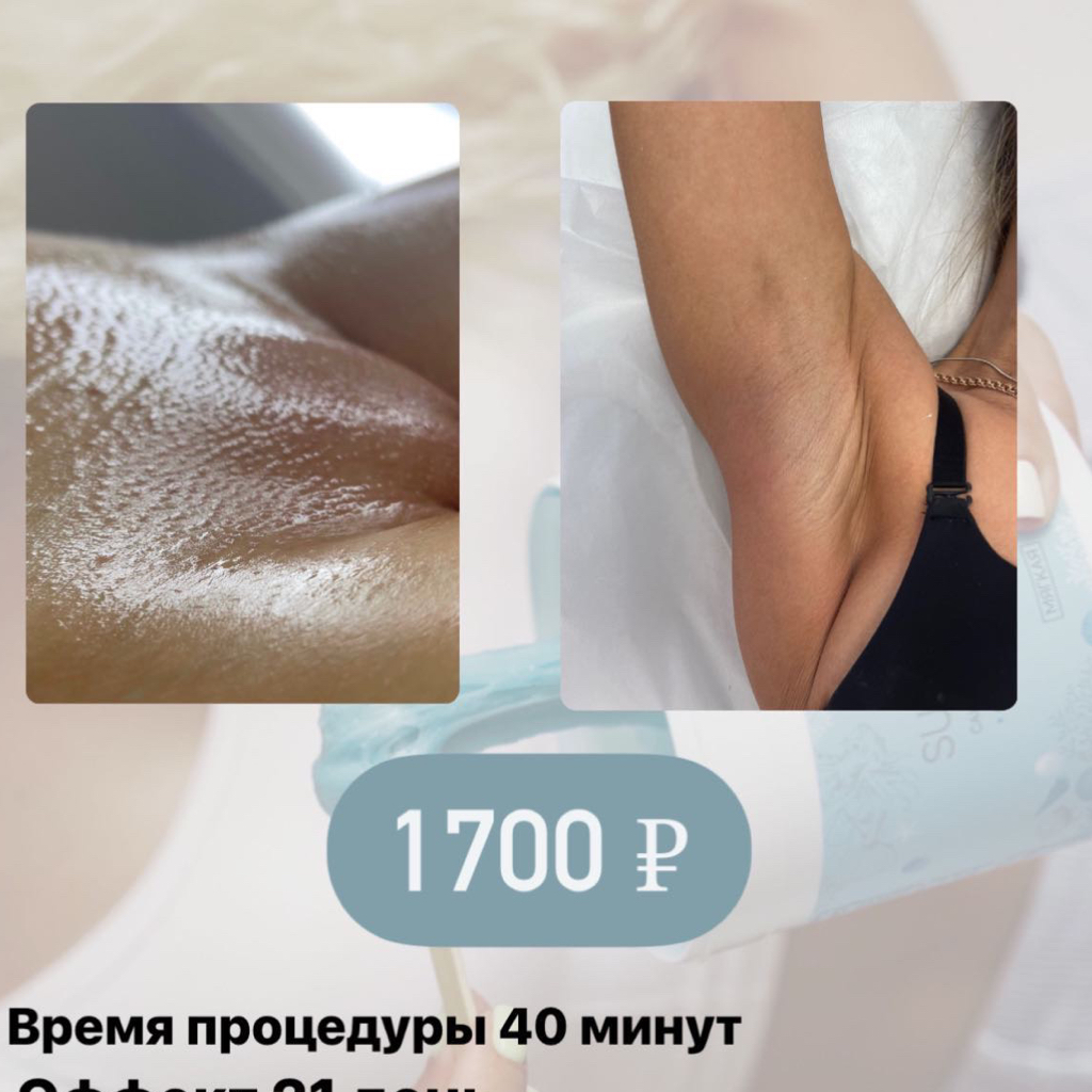Комплекс