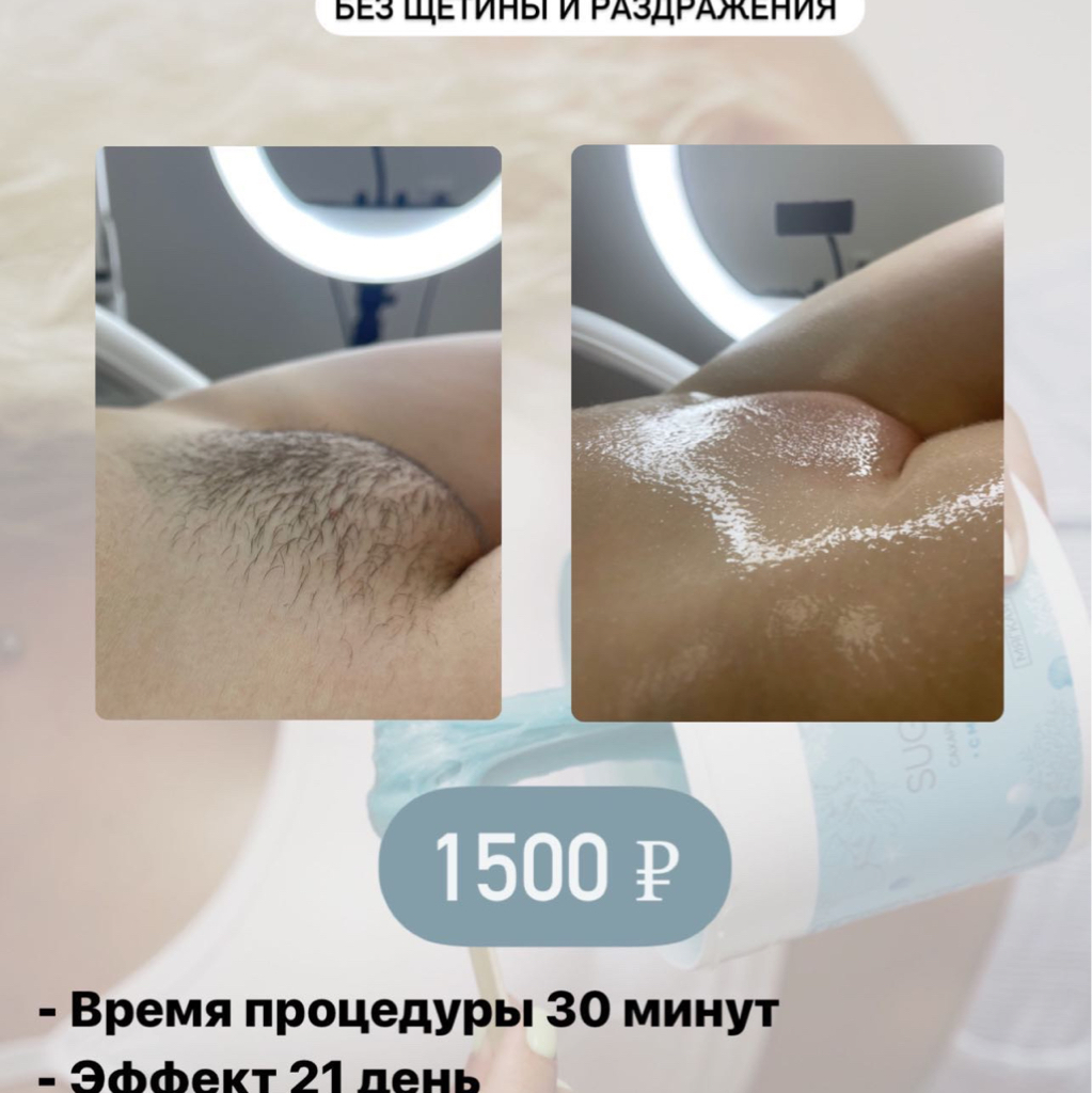Депиляция Гл бикини