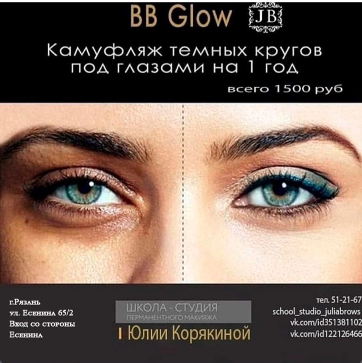 НЕТ темным кругам под глазами!!!