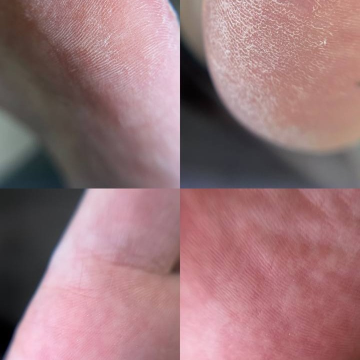 педикюр гигиенический