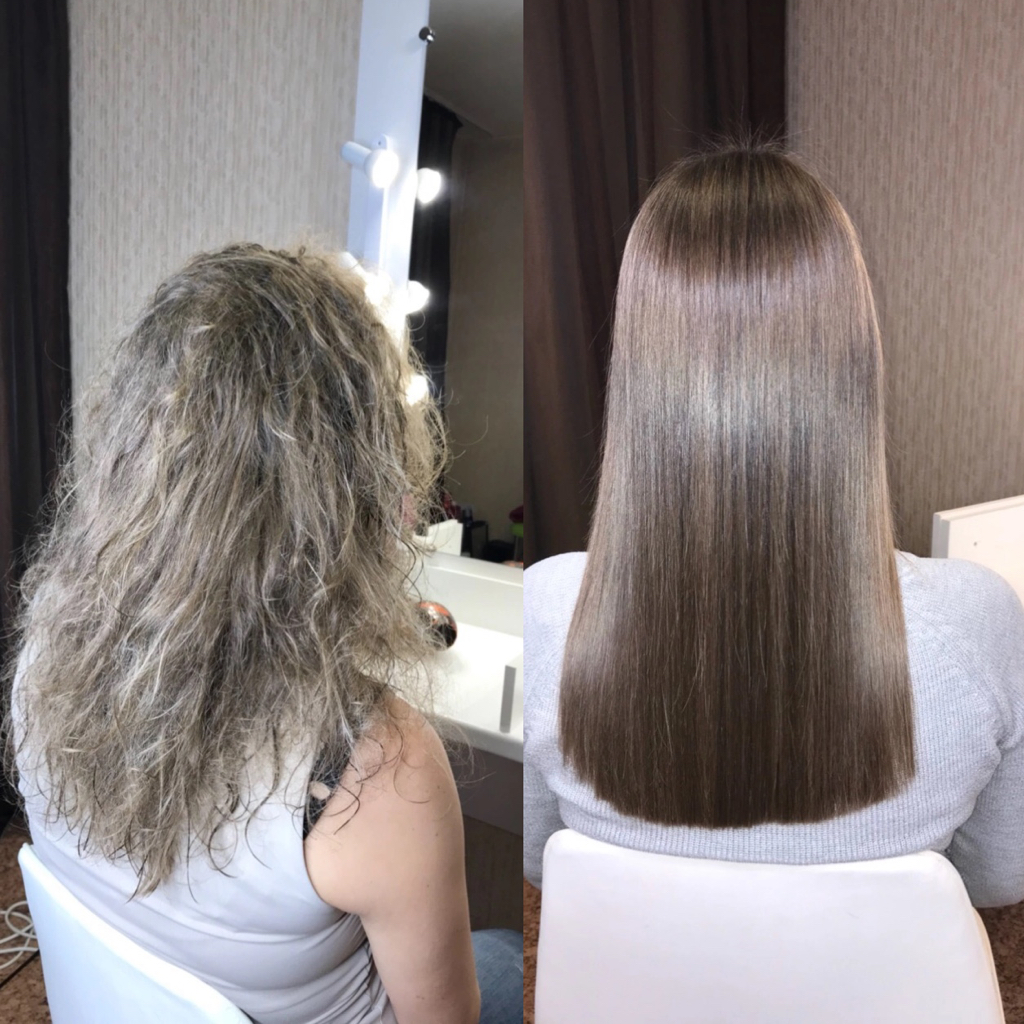 Ботокс (по лопатки)