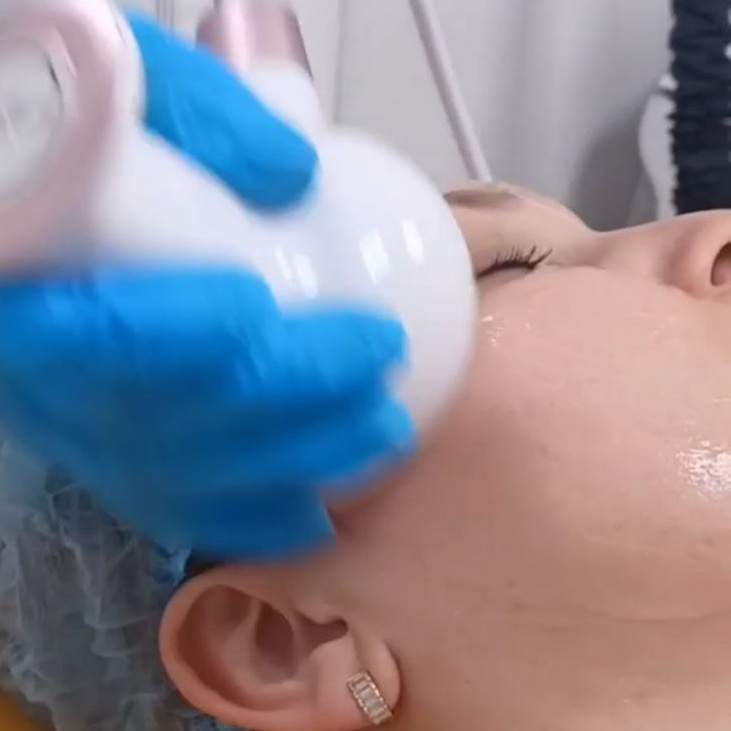 комплекс для лица hifu,rf+lpg