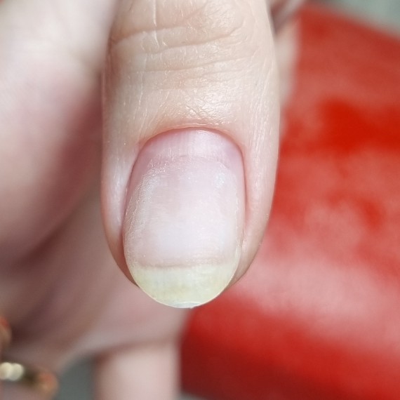 Снятие + форма