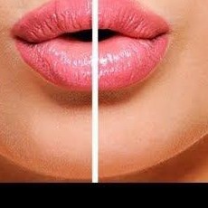 Подбородок