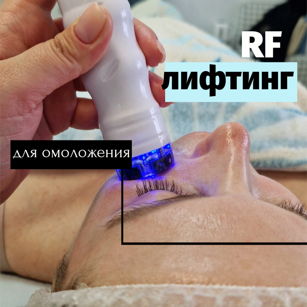 RF-лифтинг лица/рук/тела