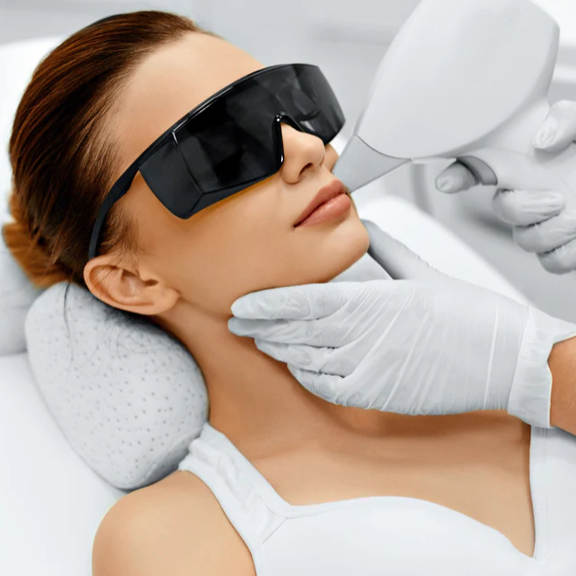 Chin Laser Hair Removal