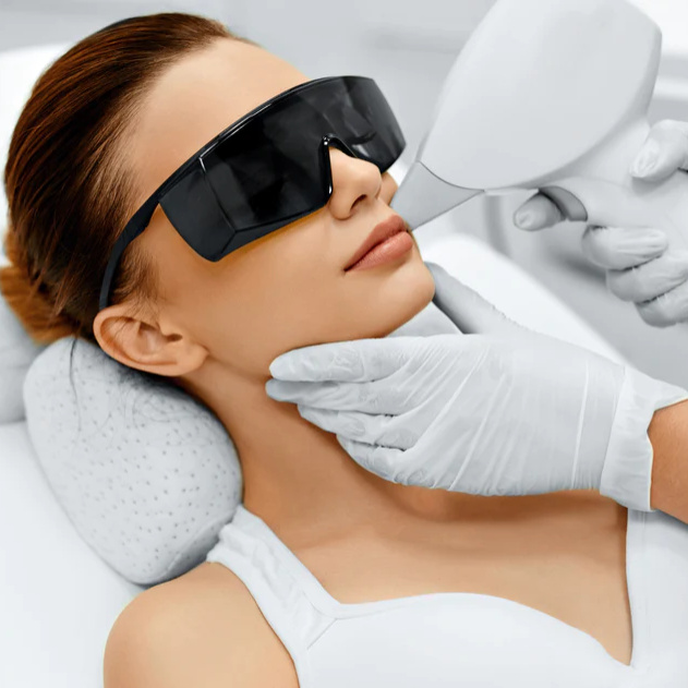 Upper Lip Laser